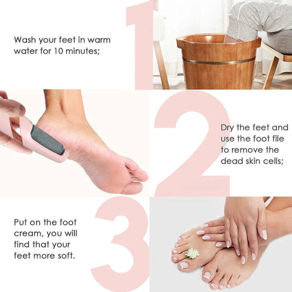 Electric Foot Callus Remover Kit – Rechargeable Pedicure Tool with 2 Rollers & Foot Care Accessories - Image 3