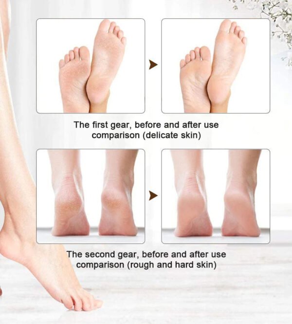 Electric Foot Callus Remover Kit – Rechargeable Pedicure Tool with 2 Rollers & Foot Care Accessories - Image 2